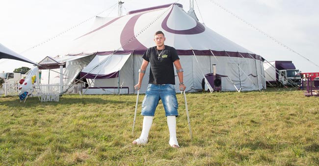 Shane Beare, a human cannonball, broke both ankles in a accident on Saturday night. He is part of Mr Tip's Wonder Circus currently travelling around Norfolk. Picture from Damien McFadden: 07968 308252